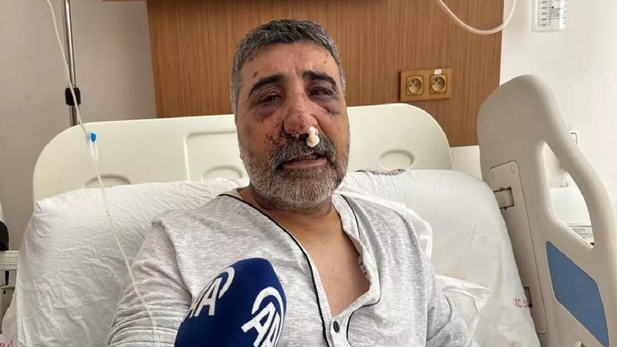 İngiliz Boksör Taksi Sürücüsünü Darbetti
