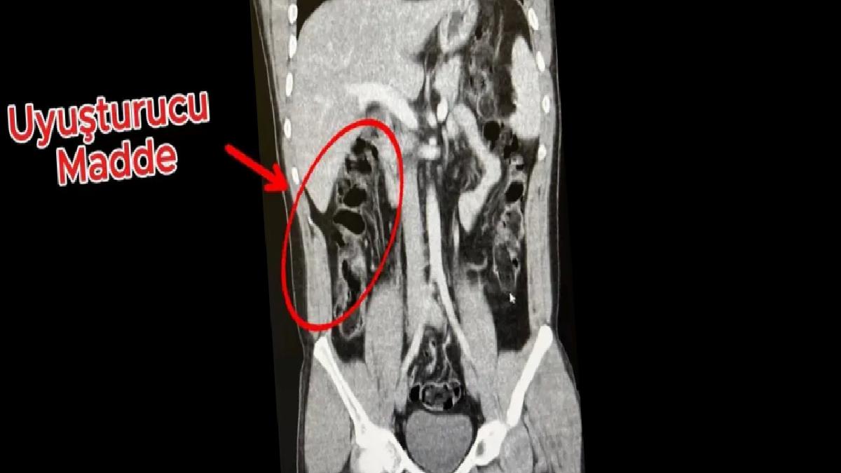 Antalya Havalimanında Uyuşturucu Ticareti Operasyonu
