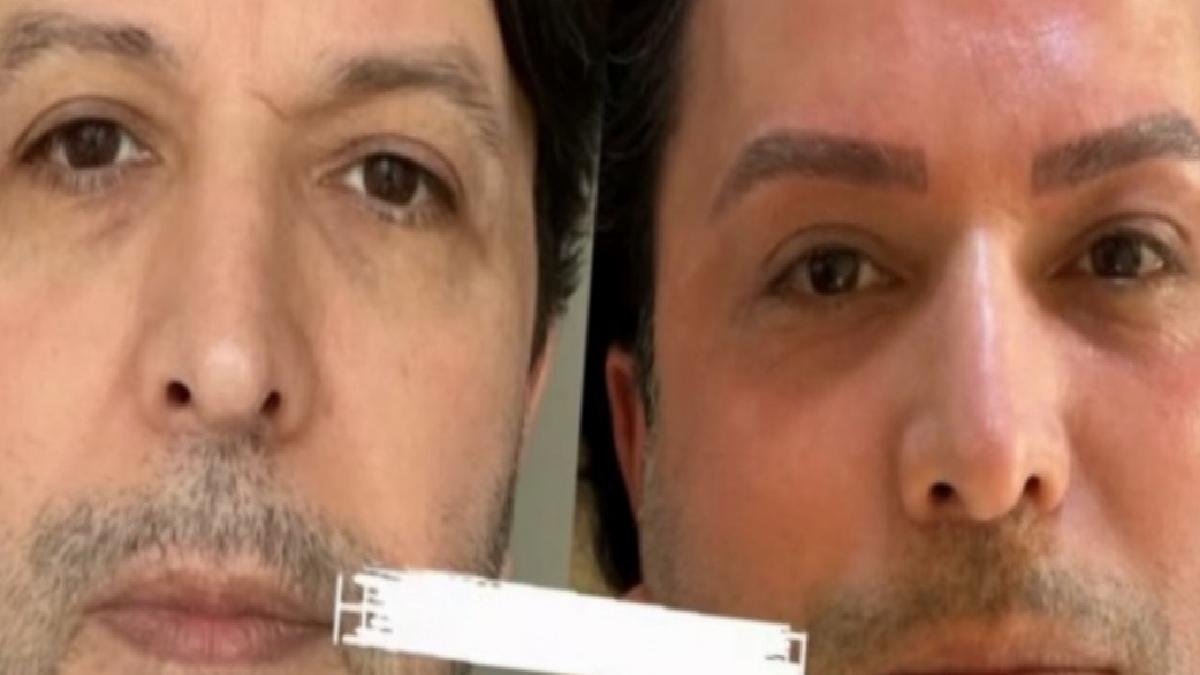 Nihat Doğan estetik süreç yaptırdı